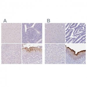 Anti-UPK2 antibody produced in rabbit 