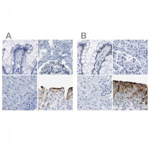 Anti-UPK3A antibody produced in rabbit 