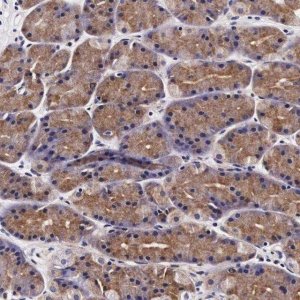 Anti-UPRT antibody produced in rabbit HPA000805-100UL