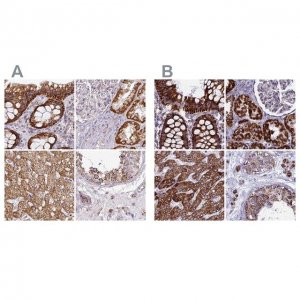 Anti-UQCRFS1 antibody produced in rabbit 