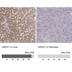 Anti-UROC1 