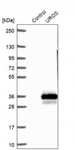 Anti-UROS antibody produced in rabbit 