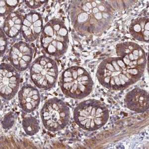 Anti-UROS antibody produced in rabbit 