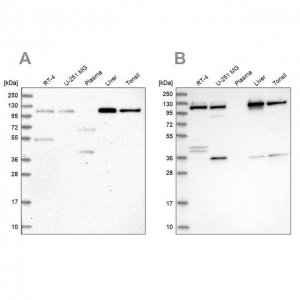 Anti-USO1 antibody produced in rabbit HPA038282-100UL