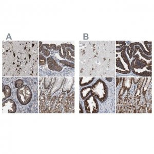 Anti-USP10 antibody produced in rabbit 