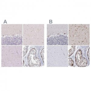 Anti-USP11 antibody produced in rabbit 