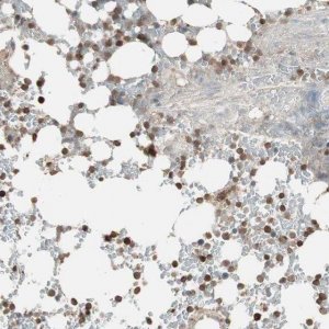 Anti-USP20 antibody produced in rabbit 