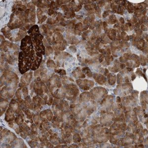 Anti-USP25 antibody produced in rabbit HPA024142-100UL