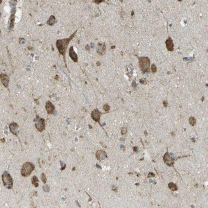 Anti-USP30 antibody produced in rabbit 