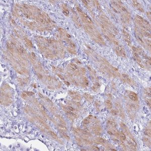 Anti-USP38 antibody produced in rabbit 
