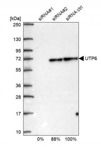 Anti-UTP6 antibody produced in rabbit 