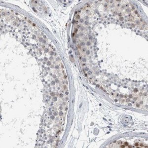 Anti-UTP6 antibody produced in rabbit 