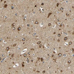 Anti-VAPB antibody produced in rabbit 