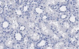 Anti-VDAC1 Antibody, clone 3M22, ZooMAb Rabbit Monoclonal 