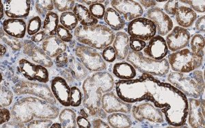 Anti-VDAC1 Antibody, clone 3M22, ZooMAb Rabbit Monoclonal 
