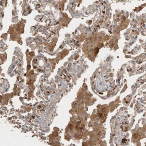 Anti-VEPH1 antibody produced in rabbit 