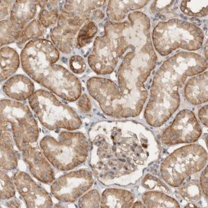 Anti-VEPH1 antibody produced in rabbit 