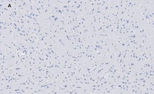 Anti-VGluT1 Antibody, clone 4O15, ZooMAb Rabbit Monoclonal 