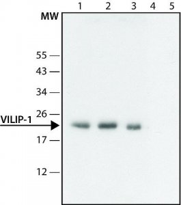 Anti-VILIP-1 (N-terminal) antibody produced in rabbit 