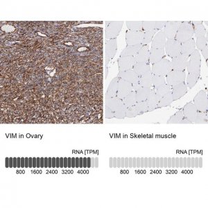 Anti-VIM antibody produced in rabbit 