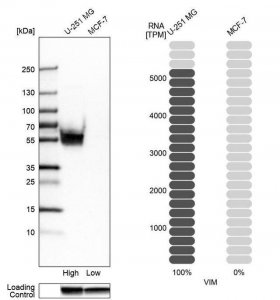 Anti-VIM antibody produced in rabbit 