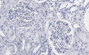 Anti-Vimentin Antibody, clone 2I13 ZooMAb Rabbit Monoclonal 