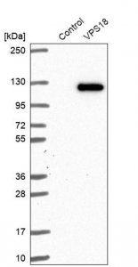 Anti-VPS18 antibody produced in rabbit 