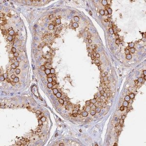 Anti-VPS18 antibody produced in rabbit 