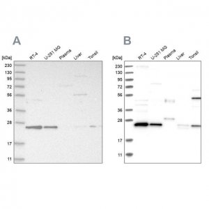 Anti-VPS28 antibody produced in rabbit 