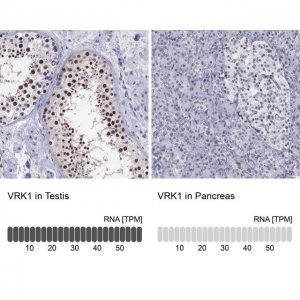 Anti-VRK1 antibody produced in rabbit 