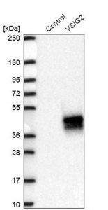 Anti-VSIG2 antibody produced in rabbit HPA050147-100UL