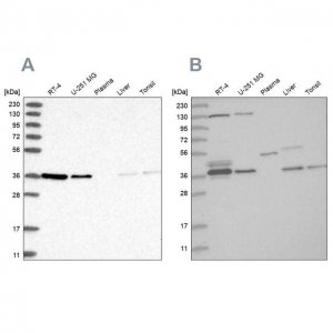 Anti-VTA1 antibody produced in rabbit HPA030969-100UL