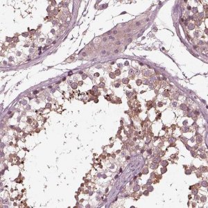 Anti-VWA5B1 antibody produced in rabbit 
