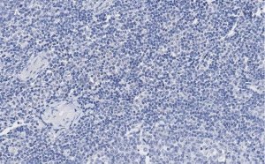 Anti-vWF Antibody, clone 1B21, ZooMAb Rabbit Monoclonal 