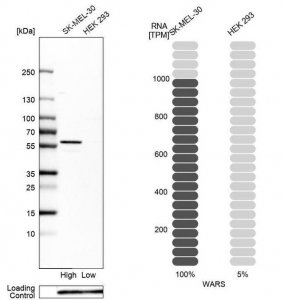 Anti-WARS antibody produced in rabbit HPA005573-100UL