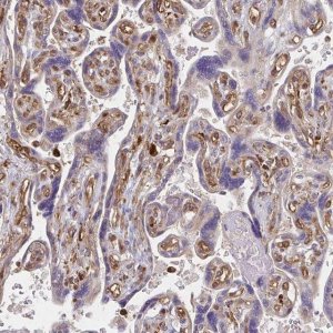 Anti-WASF2 antibody produced in rabbit 