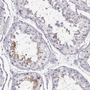 Anti-WBP2NL antibody produced in rabbit 
