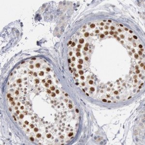 Anti-WDHD1 antibody produced in rabbit 