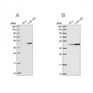 Anti-WDR18 antibody produced in rabbit HPA050193-100UL