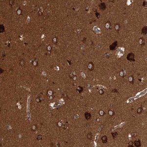 Anti-WDR37 antibody produced in rabbit 