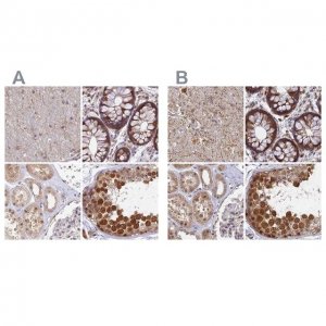 Anti-WDR61 antibody produced in rabbit 