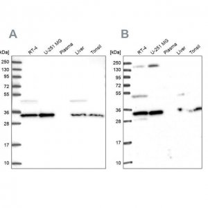 Anti-WDR61 antibody produced in rabbit 