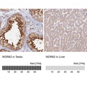 Anti-WDR62 antibody produced in rabbit 