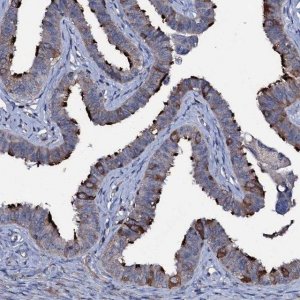 Anti-WDR66 antibody produced in rabbit 