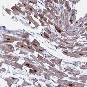 Anti-WDR83 antibody produced in rabbit 