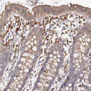 Anti-WDTC1 antibody produced in rabbit HPA028182-100UL