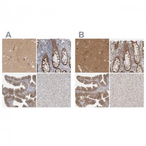 Anti-WIPF2 antibody produced in rabbit 