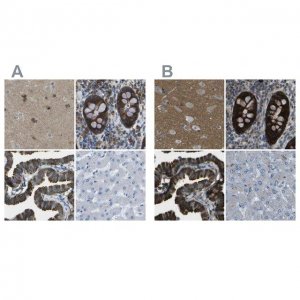 Anti-WNK2 antibody produced in rabbit 