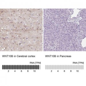 Anti-WNT10B antibody produced in rabbit 