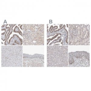 Anti-WRAP53 antibody produced in rabbit HPA023026-100UL